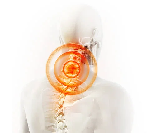 Ilustración médica del dolor en columna y articulaciones que Flexacil Ultra ayuda a aliviar