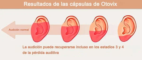 Resultados de Otovix: cómo la audición puede recuperarse en estadios 3 y 4 de pérdida auditiva